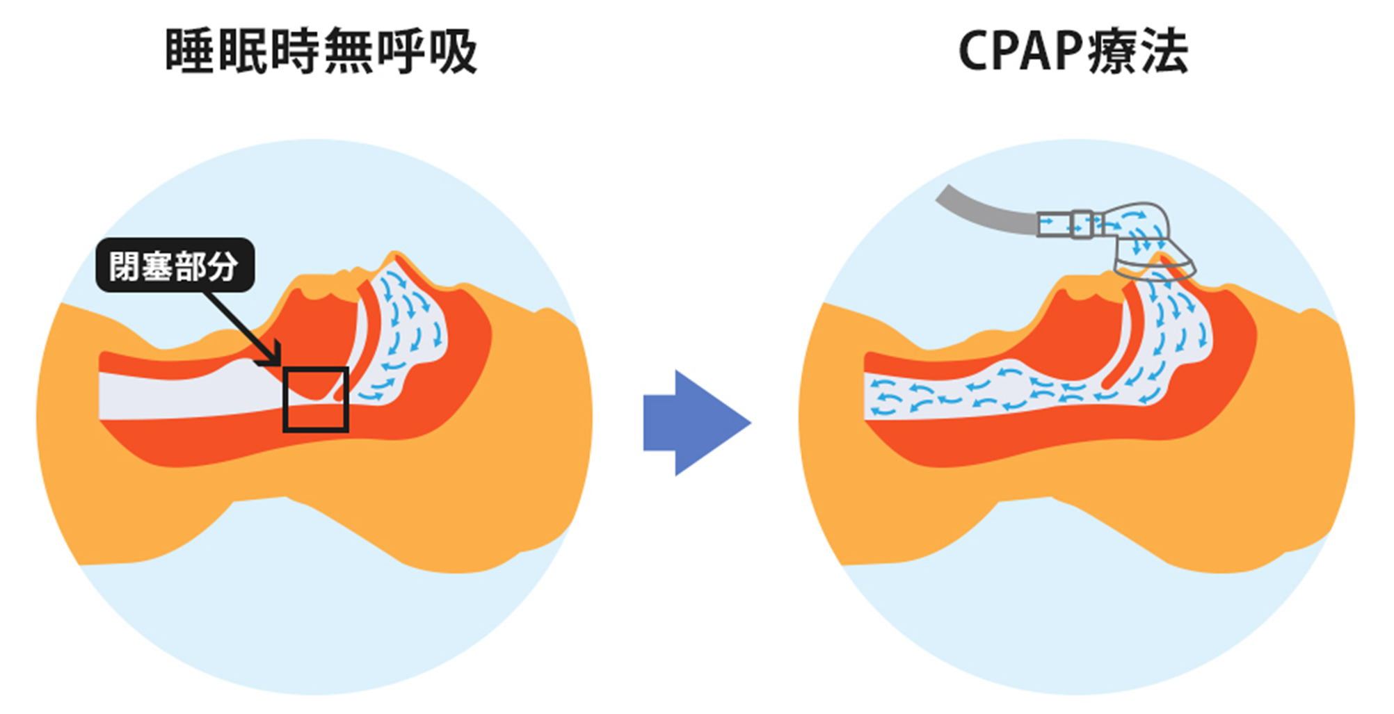 安全に関するヒント